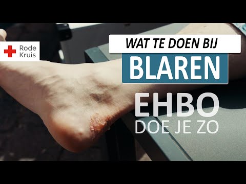 Blaar Op Hak: Wat Te Doen Voor Snelle Verlichting